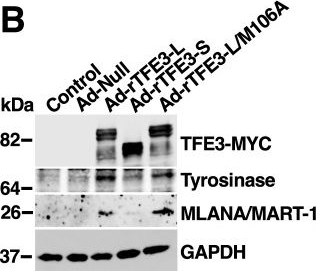 Fig.11.B showing Western Blotting from the publication: Differential contribution of TFE3 isoforms to cell motility and invasion.