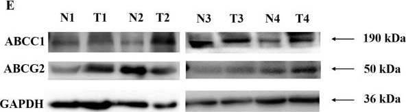 Fig.9.E showing Western Blotting in a Homo sapiens (Human) sample from the publication: Clinical relevance of CERK and SPHK1 in breast cancer and their association with metastasis and drug resistance.