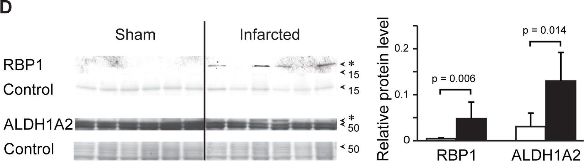 Fig.3.D showing Western Blotting from the publication: Retinoic acid signalling is activated in the postischemic heart and may influence remodelling.
