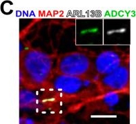 Fig.1.C showing Immunocytochemistry-immunofluorescence from the publication: A Short Sequence Targets Transmembrane Proteins to Primary Cilia.