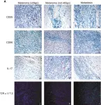 Fig.6.A showing Immunohistochemistry in a Homo sapiens (Human) sample from the publication: Insight into immune profile associated with vitiligo onset and anti-tumoral response in melanoma patients receiving anti-PD-1 immunotherapy.