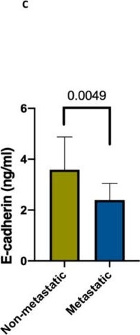 Fig.2.C showing Enzyme-linked immunosorbent assay from the publication: Association of MALAT1 and PVT1 Variants, Expression Profiles and Target miRNA-101 and miRNA-186 with Colorectal Cancer: Correlation with Epithelial-Mesenchymal Transition.