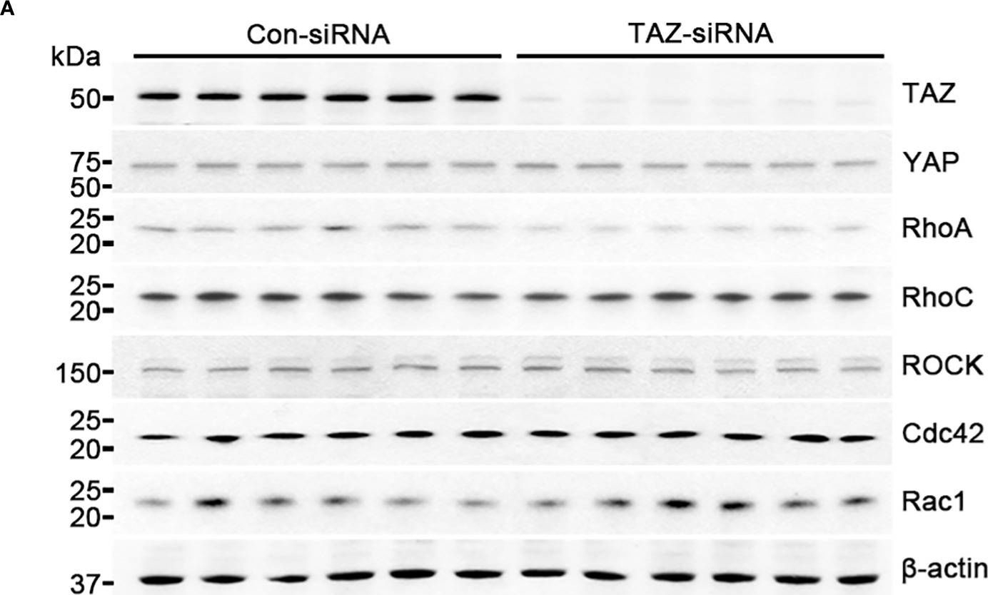 Fig.4.A showing Western Blotting in a Homo sapiens (Human) sample from the publication: TAZ is involved in breast cancer cell migration via regulating actin dynamics.
