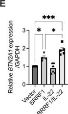 Fig.3.E from the publication: Epstein-Barr Virus BRRF1 Induces Butyrophilin 2A1 in Nasopharyngeal Carcinoma NPC43 Cells via the IL-22/JAK3-STAT3 Pathway.