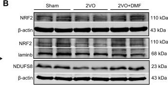 Fig.8.B showing Western Blotting in a Rattus norvegicus (Rat) sample from the publication: Targeting NDUFS8 in basal forebrain ameliorates cognitive decline related to chronic cerebral hypoperfusion.