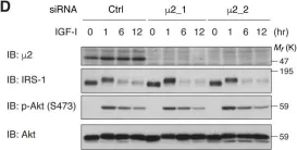 Fig.7.D showing Western Blotting in a Homo sapiens (Human) sample from the publication: IRS-1 acts as an endocytic regulator of IGF-I receptor to facilitate sustained IGF signaling.