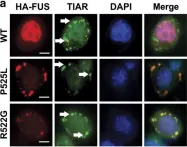 Fig.7.A showing Immunocytochemistry-immunofluorescence in a Mus musculus (House mouse) sample from the publication: ALS-associated mutant FUS inhibits macroautophagy which is restored by overexpression of Rab1.