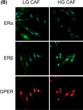 Fig.1.B showing Immunocytochemistry-immunofluorescence in a Homo sapiens (Human) sample from the publication: Differential Protumoral Mechanisms Induced by CAFs in Cervical Cancer Cells Occur Independently of 17β-Estradiol Stimulation.