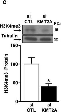 Fig.5.C showing Western Blotting in a Mus musculus (House mouse) sample from the publication: The Transcriptional Complex Sp1/KMT2A by Up-Regulating Restrictive Element 1 Silencing Transcription Factor Accelerates Methylmercury-Induced Cell Death in Motor Neuron-Like NSC34 Cells Overexpressing SOD1-G93A.