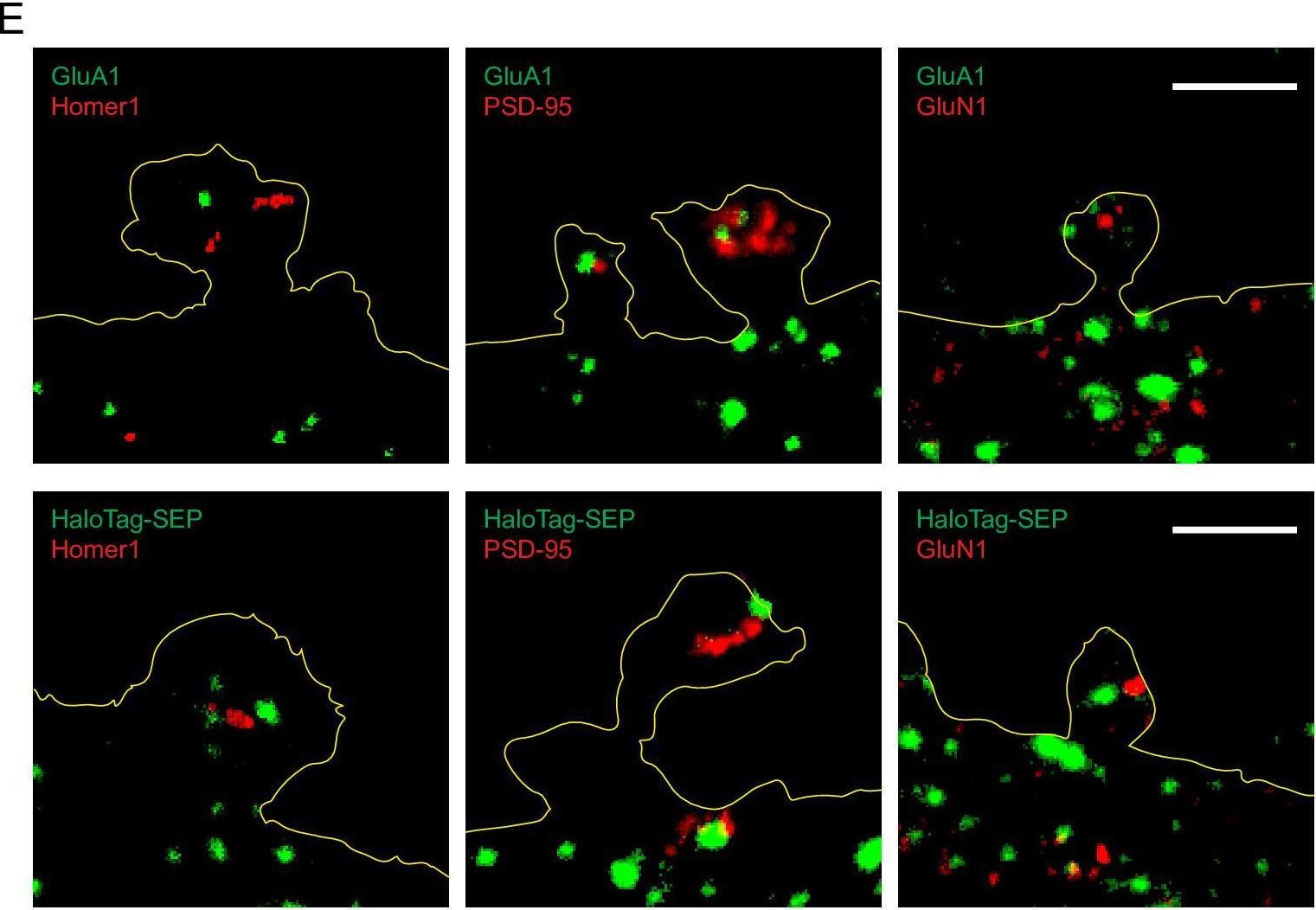 Fig.5.E showing Immunocytochemistry-immunofluorescence from the publication: Plasticity-induced actin polymerization in the dendritic shaft regulates intracellular AMPA receptor trafficking.
