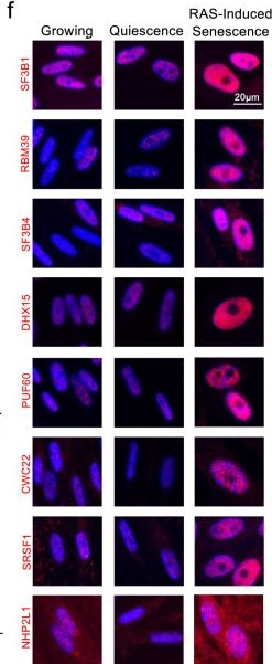 Fig.1.F showing Immunocytochemistry-immunofluorescence in a Homo sapiens (Human) sample from the publication: Spliceosome induction is a druggable dependency of RAS-driven senescence and cancer.
