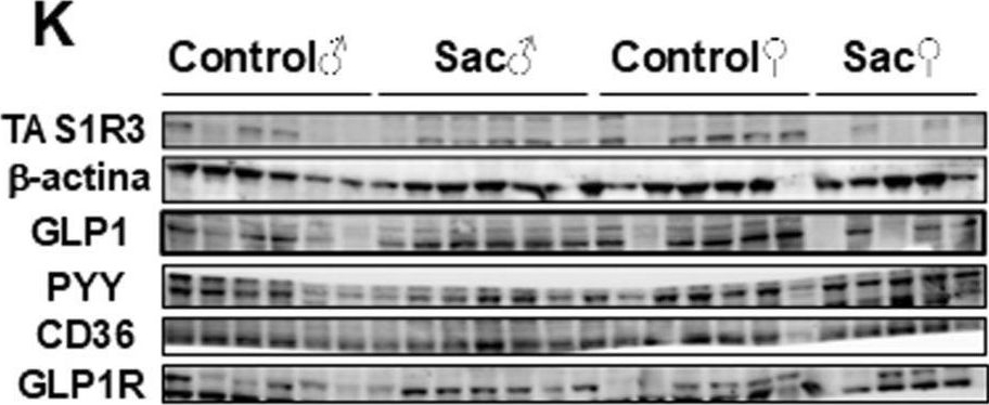 Fig.2.K showing Western Blotting in a Rattus norvegicus (Rat) sample from the publication: Gestational saccharin consumption disrupts gut-brain axis glucose homeostasis control in adolescent offspring rats in a sex-dependent manner.