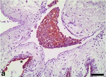 Immunohistochemical staining patterns of alpha-keratins in normal tissues from two reptile species: implications for characterization of squamous cell carcinomas.