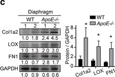 Fig.2.C showing Western Blotting in a Mus musculus (House mouse) sample from the publication: FAK-ERK activation in cell/matrix adhesion induced by the loss of apolipoprotein E stimulates the malignant progression of ovarian cancer.