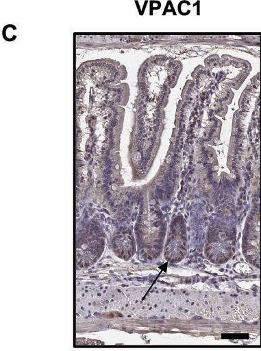 Fig.1.C showing Immunohistochemistry in a Mus musculus (House mouse) sample from the publication: Vasoactive intestinal peptide promotes secretory differentiation and mitigates radiation-induced intestinal injury.