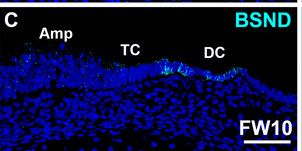 Fig.3.C showing Immunohistochemistry-immunofluorescence in a Homo sapiens (Human) sample from the publication: Developmental Expression of Membrane Pumps and Ion Channels in Human Vestibular Endolymph Homeostasis.