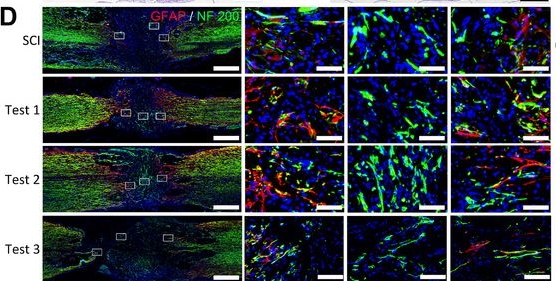 Fig.6.D showing Immunohistochemistry-immunofluorescence in a Rattus norvegicus (Rat) sample from the publication: Real-Time Feedback Strategically Regulates Optoelectronics for Customized Optogenetic Spinal Cord Regeneration.