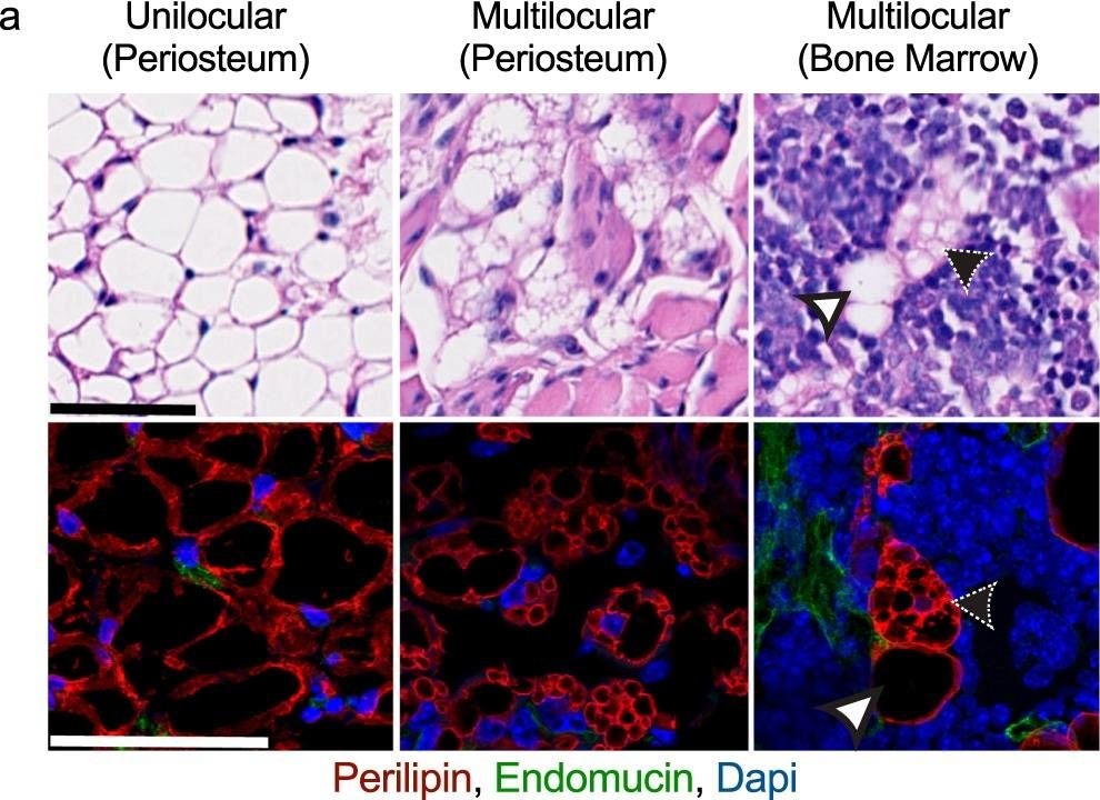 Bone marrow adipose tissue does not express UCP1 during development or adrenergic-induced remodeling.