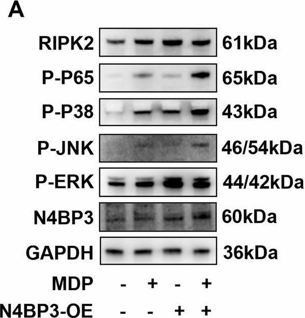 Fig.4.A showing Western Blotting in a Homo sapiens (Human) sample from the publication: N4BP3 facilitates NOD2-MAPK/NF-κB pathway in inflammatory bowel disease through mediating K63-linked RIPK2 ubiquitination.