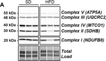 Fig.5.A showing Western Blotting in a Mus musculus (House mouse) sample from the publication: High-Fat Diet Leads to Reduced Protein O-GlcNAcylation and Mitochondrial Defects Promoting the Development of Alzheimer's Disease Signatures.
