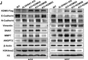 Fig.6.J showing Western Blotting from the publication: Reprogramming of valine metabolism mediated by abnormally low ALDH6A1 expression promotes invasive metastasis of gastric cancer.