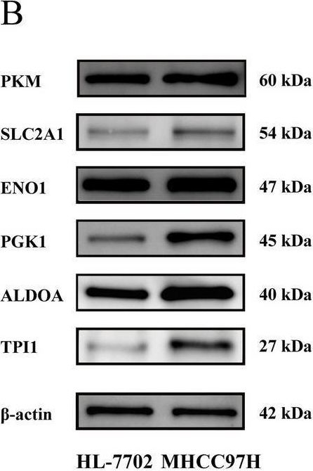 Fig.6.B showing Western Blotting from the publication: Prognostic evaluation of glycolysis markers in hepatocellular carcinoma: insights from meta-analysis and multi-omics approaches.