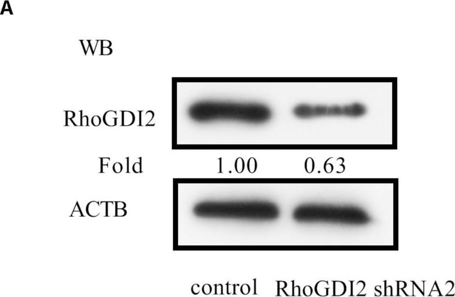 Fig.2.A showing Western Blotting in a Homo sapiens (Human) sample from the publication: Rho GDP-Dissociation Inhibitor 2 Inhibits C-X-C Chemokine Receptor Type 4-Mediated Acute Lymphoblastic Leukemia Cell Migration.