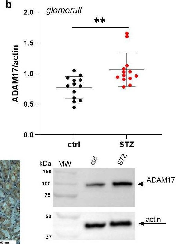 Fig.1.B showing Western Blotting in a Homo sapiens (Human) sample from the publication: Involvement of ADAM17-Klotho Crosstalk in High Glucose-Induced Alterations of Podocyte Function.