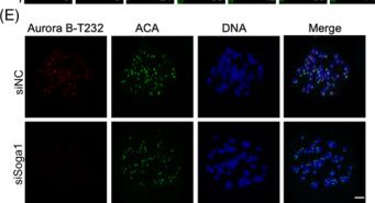 Fig.5.E showing Immunocytochemistry-immunofluorescence in a Homo sapiens (Human) sample from the publication: METTL16-mediated N6-methyladenosine modification of Soga1 enables proper chromosome segregation and chromosomal stability in colorectal cancer.