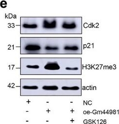 Fig.4.E showing Western Blotting from the publication: LncRNA Gm44981 modulates EZH2-H3K27me3-p21 axis to suppress mesangial cell senescence and kidney aging.