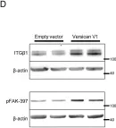 Fig.3.D showing Western Blotting from the publication: Versican V1 Overexpression Induces a Myofibroblast-Like Phenotype in Cultured Fibroblasts.