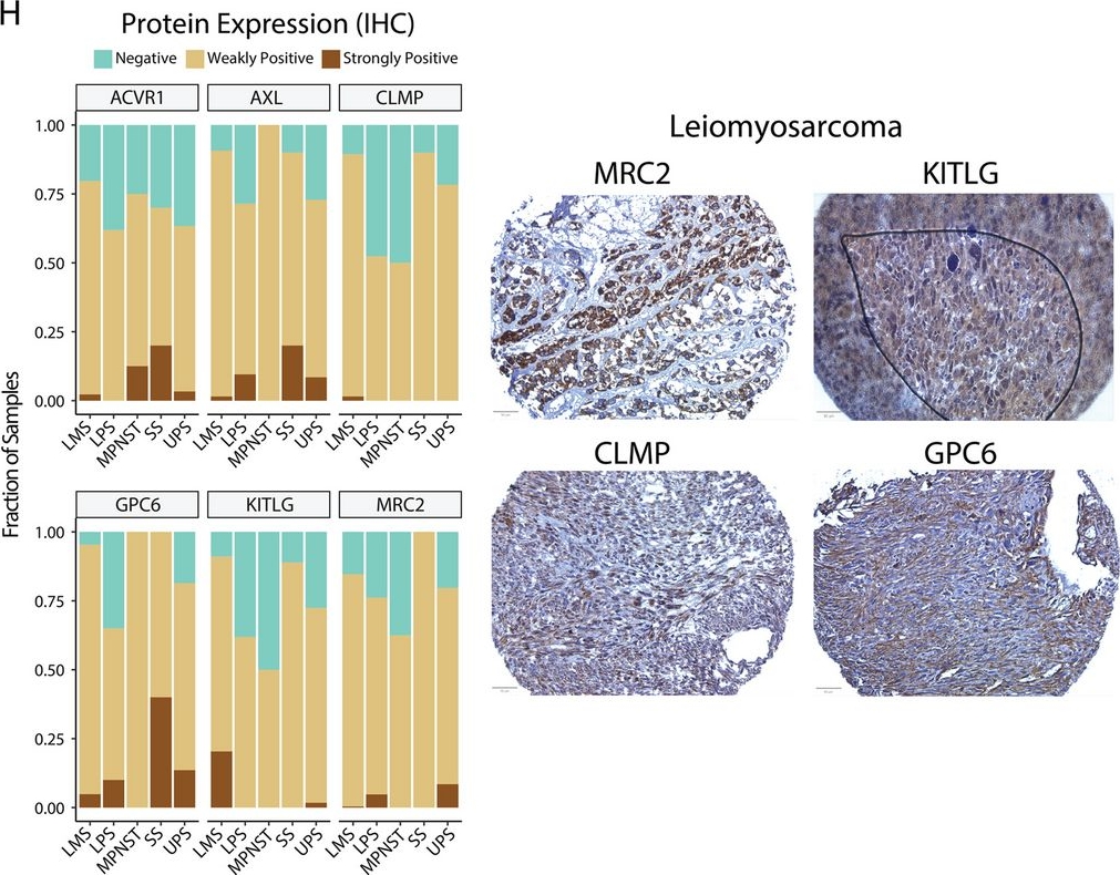 Fig.5.H showing Immunohistochemistry in a Homo sapiens (Human) sample from the publication: SCAN-ACT: adoptive T cell therapy target discovery through single-cell transcriptomics.