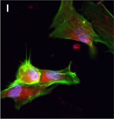 Fig.2.I showing Immunohistochemistry in a Homo sapiens (Human) sample from the publication: Chorionic gonadotropin and its receptor are both expressed in human retina, possible implications in normal and pathological conditions.