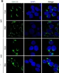 Fig.3.G showing Immunocytochemistry-immunofluorescence from the publication: TBC1D23 mediates Golgi-specific LKB1 signaling.