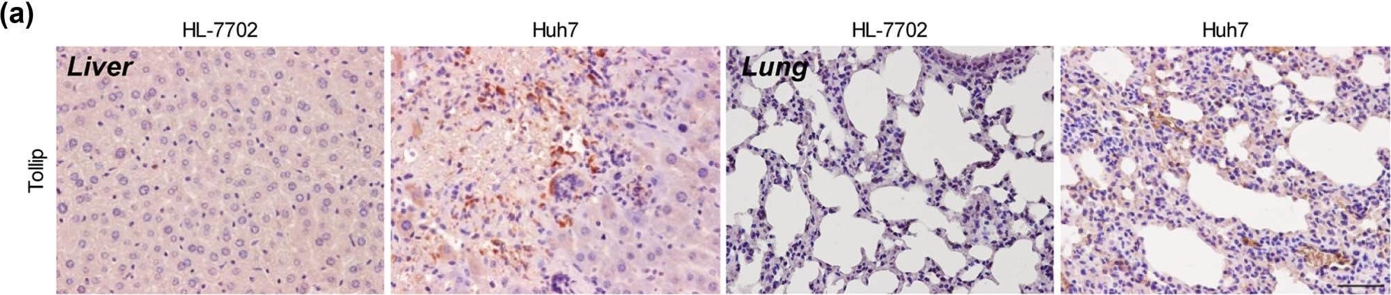 Fig.1.A showing Immunohistochemistry from the publication: Tollip promotes hepatocellular carcinoma progression via PI3K/AKT pathway.