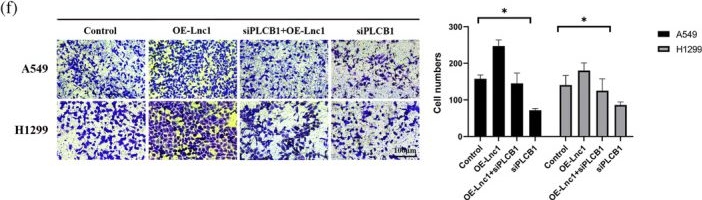 Fig.5.F showing Immunohistochemistry from the publication: LncRNA AC100826.1 regulated PLCB1 to promote progression in non-small cell lung cancer.