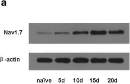 Fig.2.A showing Western Blotting in a Rattus norvegicus (Rat) sample from the publication: Membrane protein Nav1.7 contributes to the persistent post-surgical pain regulated by p-p65 in dorsal root ganglion (DRG) of SMIR rats model.