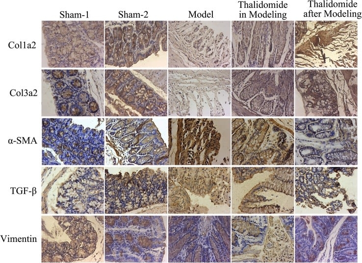 Fig.6.A showing Immunohistochemistry in a Mus musculus (House mouse) sample from the publication: Thalidomide Prevented and Ameliorated Pathogenesis of Crohn's Disease in Mice via Regulation of Inflammatory Response and Fibrosis.
