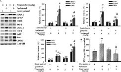 Fig.4.A showing Western Blotting from the publication: Effects of β-Adrenergic Blockade on Metabolic and Inflammatory Responses in a Rat Model of Ischemic Stroke.
