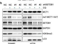 ESET (C1C12) Rabbit mAb | Cell Signaling Technology