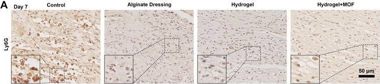 Fig.7.A showing Immunohistochemistry from the publication: Thermosensitive Hydrogel Integrated with Bimetallic Nano-Enzymes for Modulating the Microenvironment in Diabetic Wound Beds.
