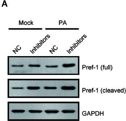 Fig.4.A showing Western Blotting from the publication: Repression of MicroRNA-124-3p Alleviates High-Fat Diet-Induced Hepatosteatosis by Targeting Pref-1.