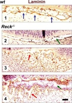 Involvement of the Reck tumor suppressor protein in maternal and embryonic vascular remodeling in mice.