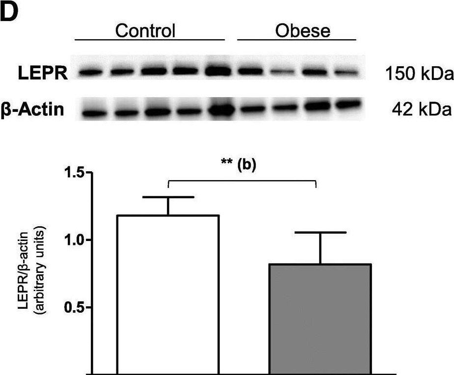 Fig.1.D showing Western Blotting in a Homo sapiens (Human) sample from the publication: Maternal obesity influences expression and DNA methylation of the adiponectin and leptin systems in human third-trimester placenta.