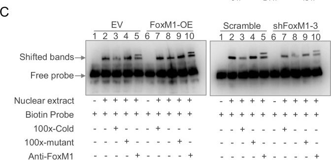 Fig.5.C showing Western Blotting in a Homo sapiens (Human) sample from the publication: A FoxM1/Smad4 positive feedback loop promotes pancreatic cancer progression.