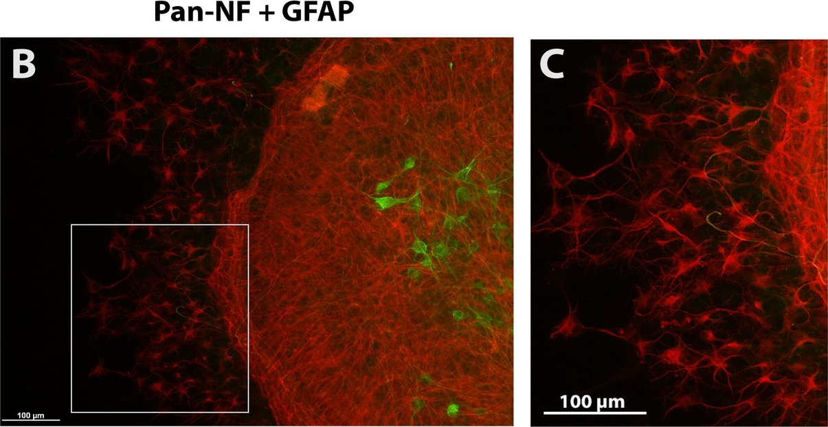Prolonged minocycline treatment impairs motor neuronal survival and glial function in organotypic rat spinal cord cultures.