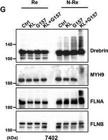 Fig.6.G showing Western Blotting in a Homo sapiens (Human) sample from the publication: Inhibition of Endoplasmic Reticulum Stress Cooperates with SLC7A11 to Promote Disulfidptosis and Suppress Tumor Growth upon Glucose Limitation.