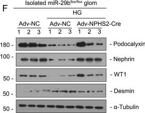 Fig.9.F showing Western Blotting in a Mus musculus (House mouse) sample from the publication: MicroRNA-29b Plays a Vital Role in Podocyte Injury and Glomerular Diseases through Inducing Mitochondrial Dysfunction.