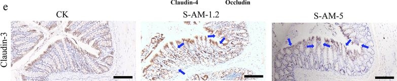Fig.5.E showing Immunohistochemistry in a Rattus norvegicus (Rat) sample from the publication: S-amlodipine induces liver inflammation and dysfunction through the alteration of intestinal microbiome in a rat model.