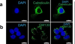 Fig.6.A showing Immunocytochemistry-immunofluorescence from the publication: Hyperglycemia induced cathepsin L maturation linked to diabetic comorbidities and COVID-19 mortality.